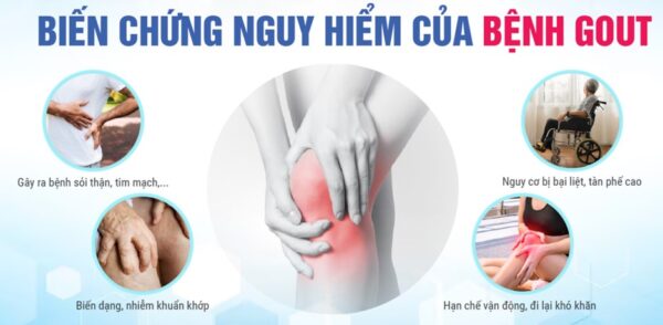 Sản phẩm dinh dưỡng Nutri Gout Pro dành riêng cho người bị Gout, bổ sung dinh dưỡng, giảm triệu chứng sưng khớp - Hình ảnh 4